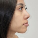 CNX Tattoo Septum Piercing Titan gestochen von CNX Tattoo Berlin Prenzlauer Berg